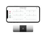 KardiaMobile 6L Personal EKG Monitor with Most Smartphones - Image 2